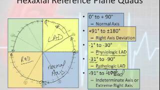 12 Lead Interpretation Part 3 Rwave Progression Electrical Vectors amp Axis Deviations [upl. by Acnaib]