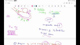 Valvular heart disease Aortic valvepart 2 [upl. by Malcah752]