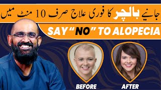 What is Alopecia Hair Loss Disease  Balchar Ki Wajah Aur Ilaj in Urdu [upl. by Airahcaz627]