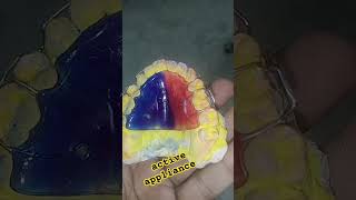 active appliance by ali dental ceramic 😁😁😁artificialteeth dentist anteriorteeth permanentteeth [upl. by Irollam]