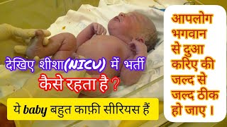 Newborn baby admission in neonatal ICU shorts livevideo babyvideo liveshorts live newborn [upl. by Ybreh]