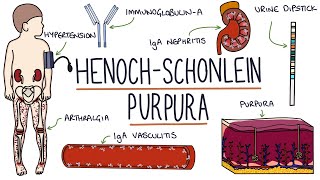 HenochSchonlein Purpura Visual Explanation for Students [upl. by Milburn]