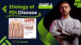 Etiology Of PDL Disease  Part 2 [upl. by Flinn]