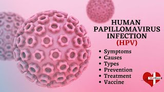 Human papillomavirus infection  HPV  What is HPV amp How do you get it [upl. by Julita]