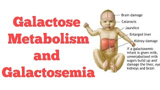 Galactose metabolism  Biochemistry [upl. by Jolie]