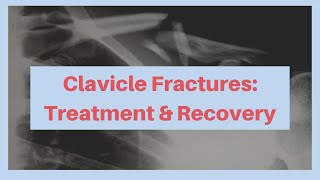 What is the treatment and recovery from a clavicle fracture [upl. by Merriam440]