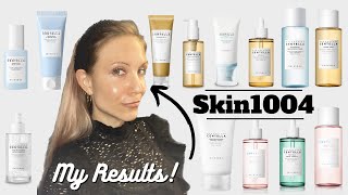 Skin1004 Review amp Whats the Difference Between the Lines [upl. by Brenza]