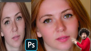 Fastest way to clean your face in photoshop  Remove pimples acne easily  Photoshop tutorial [upl. by Derte]