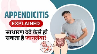 Appendicitis in Hindi  Causes Karan Symptoms Tests Lecture amp Treatment  Appendix Kya Hota Hai [upl. by Ahsirk]