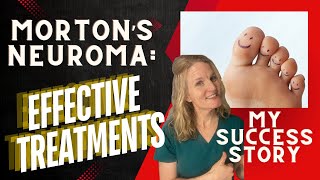 Mortons Neuroma Podiatrist shares Effective Treatments and Her Personal Success Story [upl. by Eiramllij596]