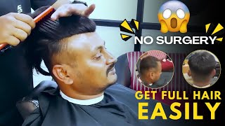 Hair patch for Hair Loss  hair fixing in Bangalore 8088899099 [upl. by Gibby]