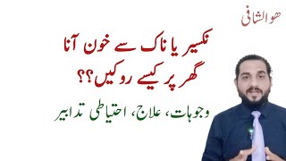 Nakseer ka ilaj in urdu  نکسیر کیوں آتی ہے  Epistaxis ent lecture  Dr Talha [upl. by Seerdi]