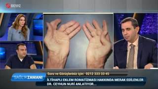 Romatoid Artrit  İltihaplı Eklem Romatizması  Dr Ceyhun Nuri  Beyaz TV Sağlık Zamanı Programı [upl. by Nolie722]