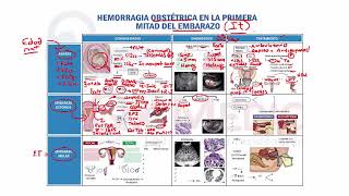 MAPA MENTAL HEMORRAGIA 1° MITAD DEL EMBARAZO QX MEDIC RM 2020 [upl. by Volding]