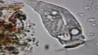 Rotifer at x600 under Celestron PentaView Digital [upl. by Netsrik]