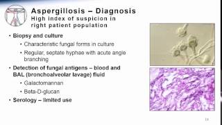 Aspergillosis [upl. by Ber708]