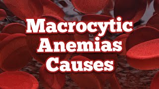 Causes of Macrocytic Anemias  Mnemonic [upl. by Ysset184]