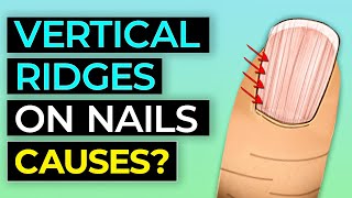 10 Things Your Nails Can Tell You About Your Health [upl. by Lore]