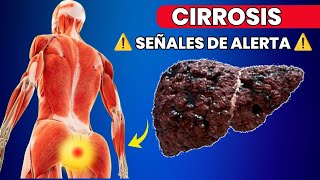 11 Señales Tempranas de Cirrosis Hepática que No Debes Ignorar [upl. by Bronez]