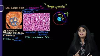 Renal Pathology Rapid Revision For FMGE amp NEET PG By Dr Preeti Sharma [upl. by Sirromal302]