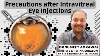 आँख में इंजेक्शन के बाद की सावधानियाँ l Precautions after eye injection [upl. by Caldeira]