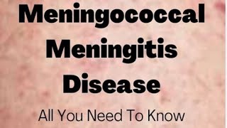 Meningococcal meningitis  social pharmacy 1st year d pharmacy pharmacist biology pharmacy neet [upl. by Florian201]