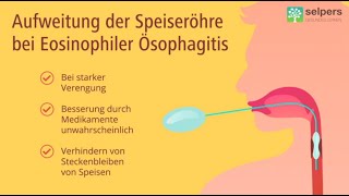 Aufweitung der Speiseröhre bei Eosinophiler Ösophagitis Arzt erklärt [upl. by Margarette]