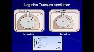 An Introduction to Mechanical Ventilation Mechanical Ventilation  Lecture 1 [upl. by Sonja526]