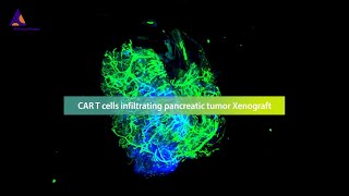 Revolutionizing the monitoring of CAR T cell therapies against solid tumors with the 3D imaging [upl. by Ulphia]