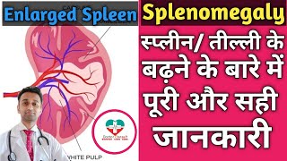 Splenomegaly। Speen प्लीहा तील्ली के बारे में पूरी जानकारी। CausesTypesTreatment Of Splenomgaly [upl. by Nagrom]