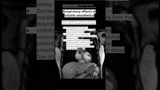 Respiratory effects of volatile anesthetics [upl. by Naoj]