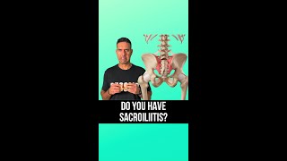 🔍 Suspecting Sacroiliitis 🔍 [upl. by Anait]