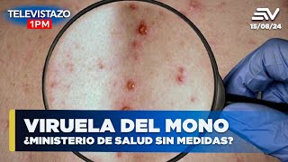 Viruela del mono ¿Ministerio de salud sin medidas  Televistazo 1PM ENVIVO🔴 [upl. by Champ]