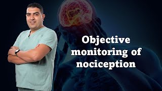 Objective monitoring of nociception [upl. by Eiro]