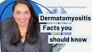 Dermatomyositis Facts your Rheumatologist wants you to know [upl. by Juetta]