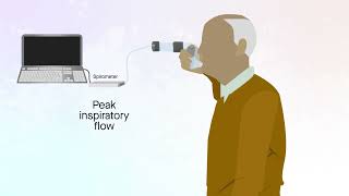 Easyhaler dry powder inhaler in patients with COPD [upl. by Nnylyahs]