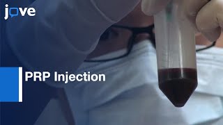 PRP Injection for Knee Osteoarthritis Evaluation Protocol Preview [upl. by Kisung4]