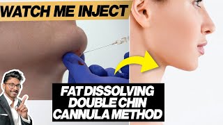 Fat Dissolving Injections For Double Chin Cannula HowTo [upl. by Leay]