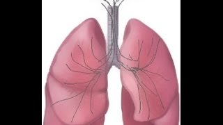 BREATH SOUNDS Stages of Fluid Overload Pneumonia [upl. by Aynosal486]