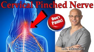 How to Overcome Cervical Pinched Nerve amp Radiculopathy Dont Panic  Dr Alan Mandell DC [upl. by Rosenblast]