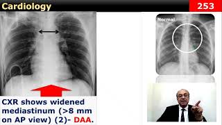 internalmedicine cme usmle محاضراتباطنة ecg كورساتباطنة clinical clinical medicine [upl. by Sivrahc]