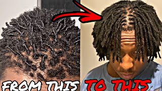 How I Got The Best Freeform Locs Ever 1 Year Dreadlock Journey [upl. by Nirot]