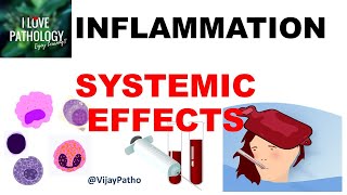 INFLAMMATION Part 10 Systemic effects of Inflammation [upl. by Martreb]