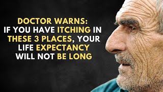 Doctor Warning If you have Itching in these 3 Places Your Life Expectancy Will not be Long [upl. by Naltiak]