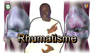 1  Rhumatisme Symptômes et Causes  Pr Ousmane Ndiaye  SAMA XALAAT TV [upl. by Odele]