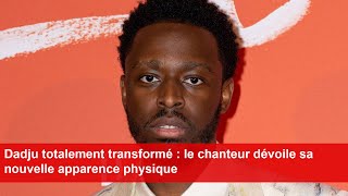 Dadju totalement transformé  le chanteur dévoile sa nouvelle apparence physique [upl. by Atteiluj]