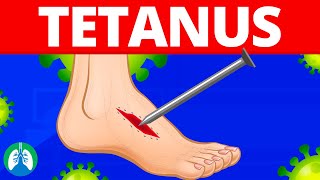 Tetanus Medical Definition  Quick Explainer Video [upl. by Wash]