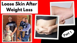 Loose Skin After Weight Loss Causes and Prevention Strategies [upl. by Nyar]