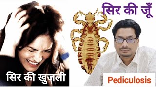 सिर की जूँ के कारण खुजली  Pediculosis  Head Lice  scalp itching  Head Lice infestation licecomb [upl. by Kuehn]