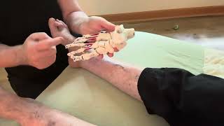 Part 2 Hammer Toe Metatarsalgia and Bunions Treatment Solutions The myofascial big picture [upl. by Aleek]